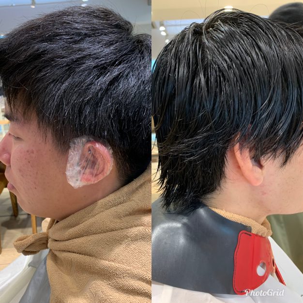 男性の硬毛のお悩みの解説