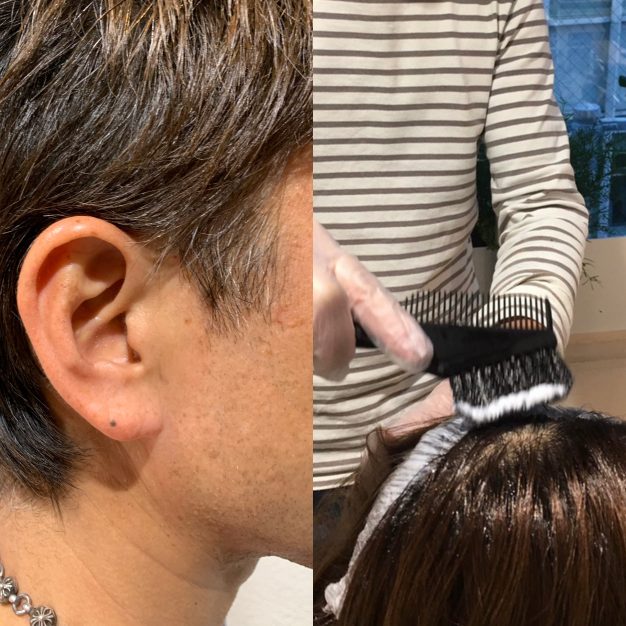 男性の白髪のお悩みの解説