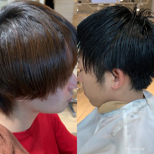 男性の多毛のお悩みの解説